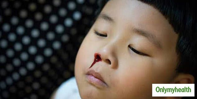 nosebleeds-first-aid-faculty-of-medicine